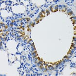 Immunohistochemistry - Anti-IQGAP1 Antibody (A14902) - Antibodies.com