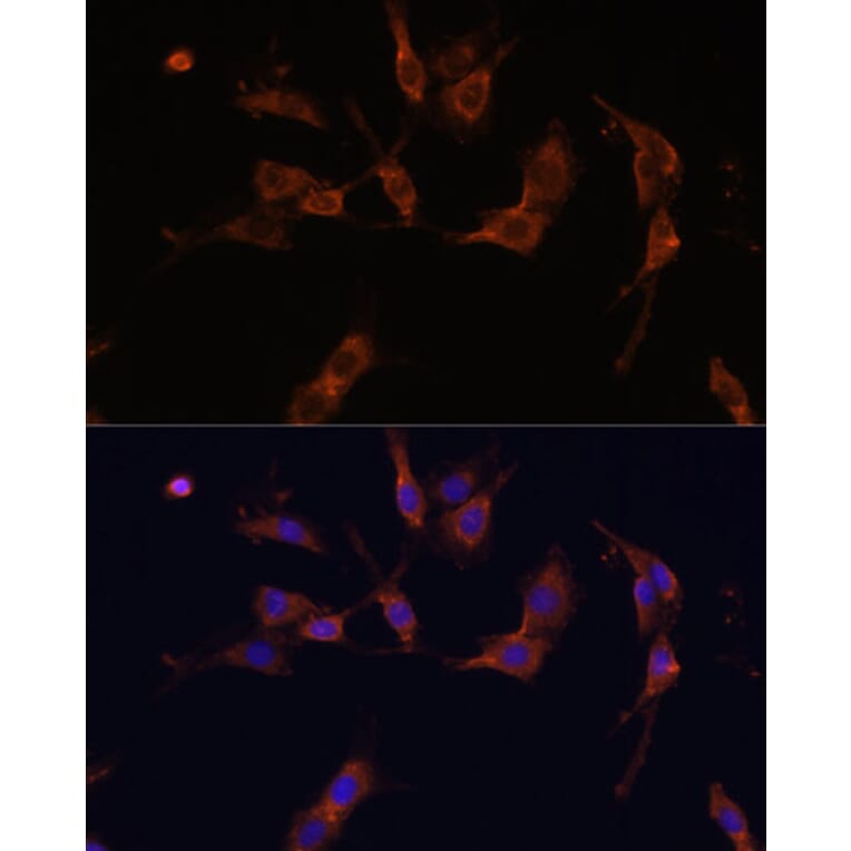 Immunofluorescence - Anti-IQGAP1 Antibody (A14902) - Antibodies.com