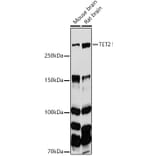 Western Blot - Anti-Tet2 Antibody (A14903) - Antibodies.com