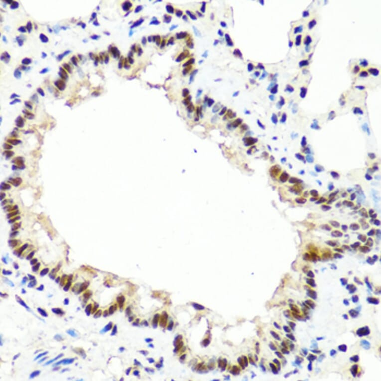 Immunohistochemistry - Anti-Tet2 Antibody (A14903) - Antibodies.com