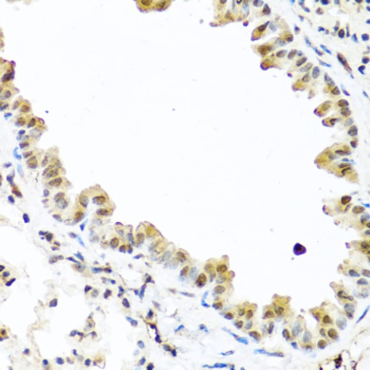 Immunohistochemistry - Anti-Tet2 Antibody (A14903) - Antibodies.com