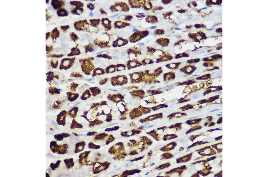 Immunohistochemistry - Anti-BNIP3 Antibody (A14904) - Antibodies.com