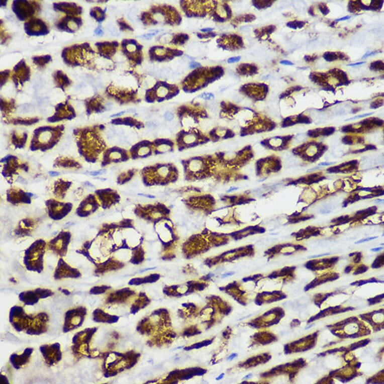 Immunohistochemistry - Anti-BNIP3 Antibody (A14904) - Antibodies.com