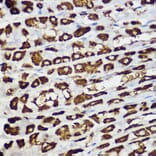 Immunohistochemistry - Anti-BNIP3 Antibody (A14904) - Antibodies.com