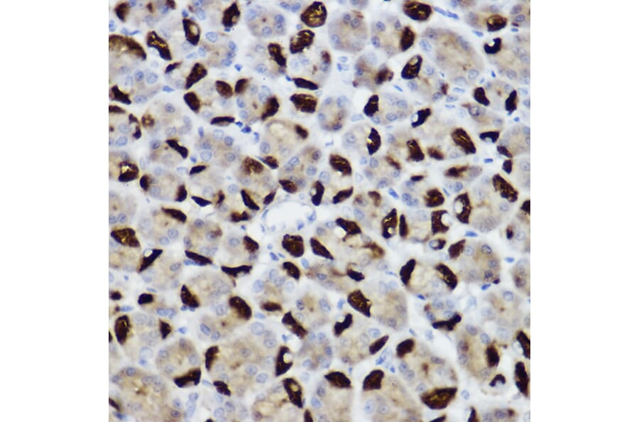 Immunohistochemistry - Anti-BNIP3 Antibody (A14904) - Antibodies.com