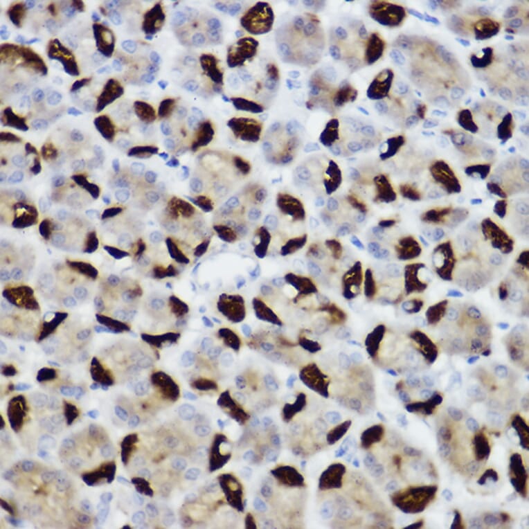 Immunohistochemistry - Anti-BNIP3 Antibody (A14904) - Antibodies.com