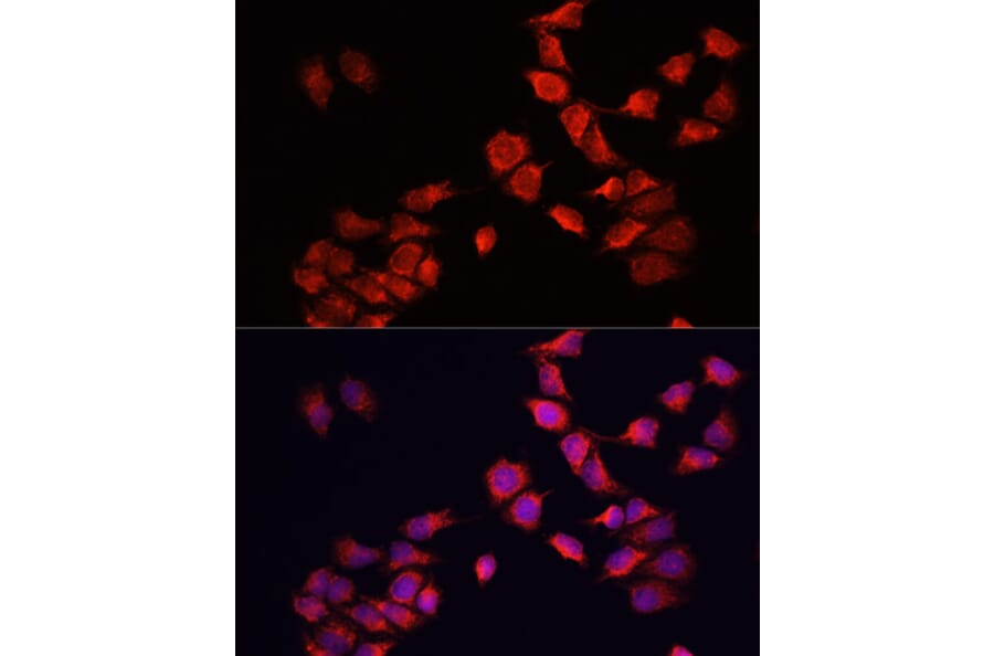 Immunofluorescence - Anti-BNIP3 Antibody (A14904) - Antibodies.com