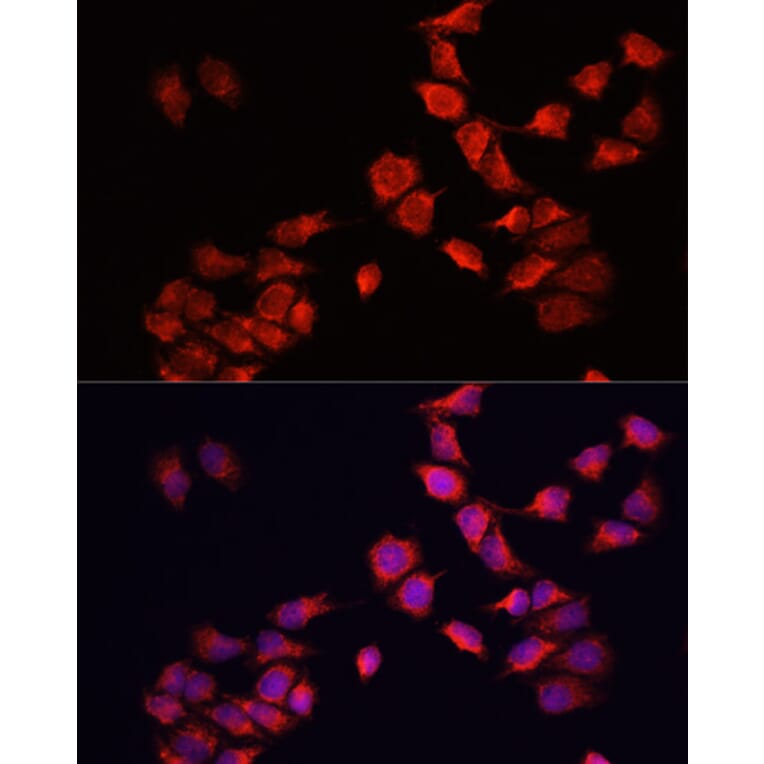 Immunofluorescence - Anti-BNIP3 Antibody (A14904) - Antibodies.com