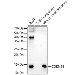 Western Blot - Anti-p15 INK4b Antibody (A14905) - Antibodies.com