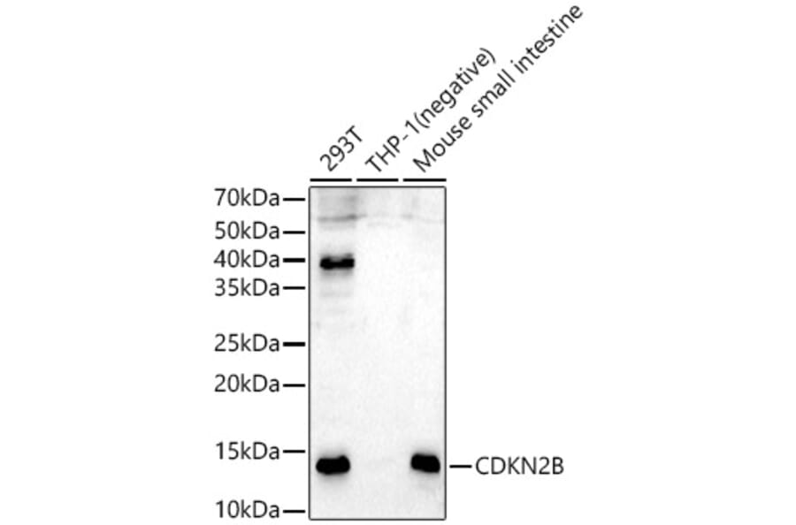 Western Blot - Anti-p15 INK4b Antibody (A14905) - Antibodies.com