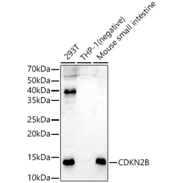 Western Blot - Anti-p15 INK4b Antibody (A14905) - Antibodies.com