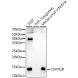 Western Blot - Anti-p15 INK4b Antibody (A14905) - Antibodies.com