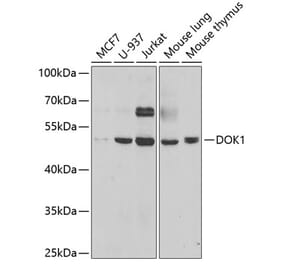 Western Blot - Anti-DOK1 Antibody (A14906) - Antibodies.com