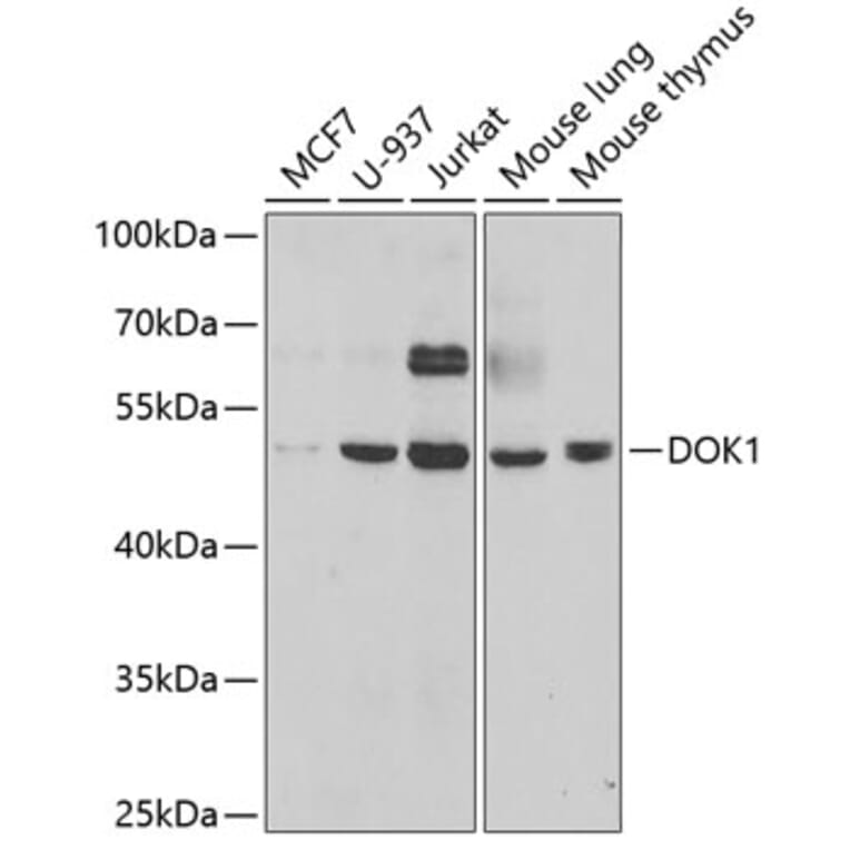 Western Blot - Anti-DOK1 Antibody (A14906) - Antibodies.com