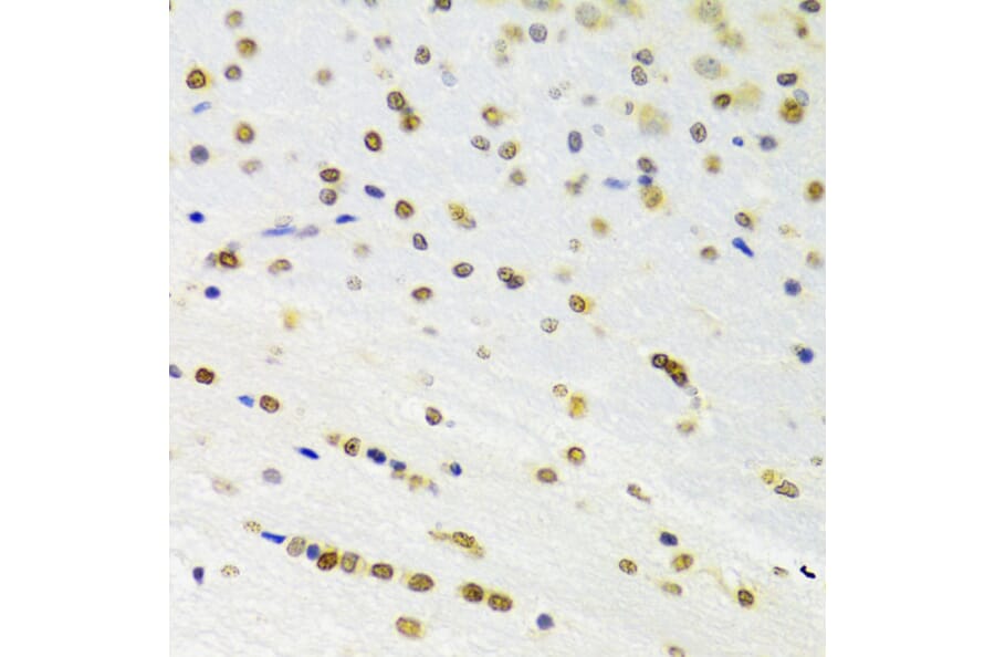 Immunohistochemistry - Anti-DOK1 Antibody (A14906) - Antibodies.com