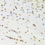 Immunohistochemistry - Anti-DOK1 Antibody (A14906) - Antibodies.com