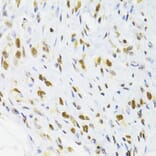 Immunohistochemistry - Anti-DOK1 Antibody (A14906) - Antibodies.com