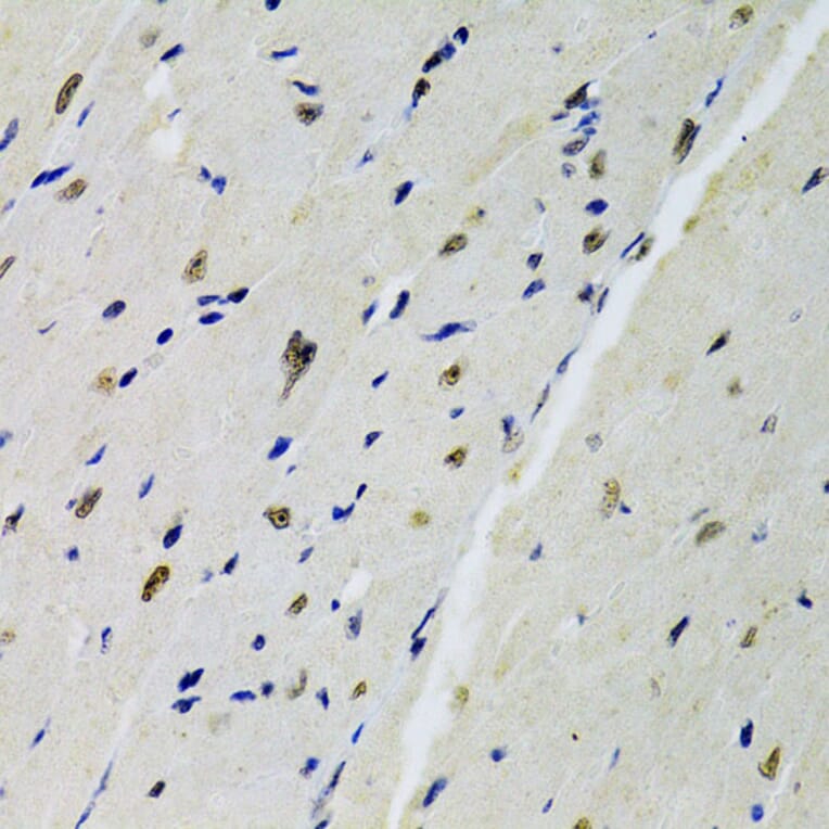 Immunohistochemistry - Anti-DOK1 Antibody (A14906) - Antibodies.com