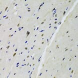 Immunohistochemistry - Anti-DOK1 Antibody (A14906) - Antibodies.com
