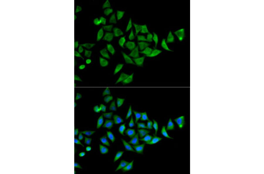 Immunofluorescence - Anti-DOK1 Antibody (A14906) - Antibodies.com