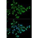 Immunofluorescence - Anti-DOK1 Antibody (A14906) - Antibodies.com
