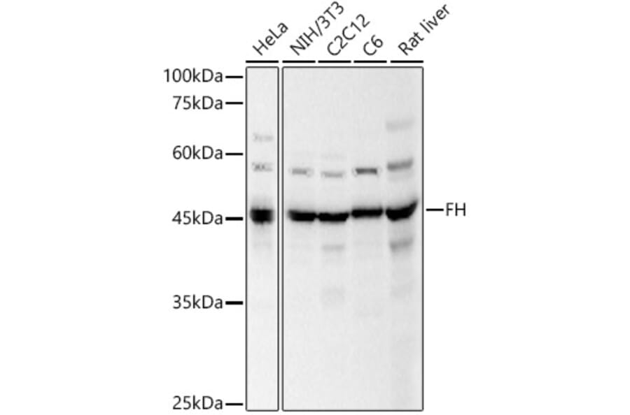 Western Blot - Anti-FH/Fumarase Antibody (A14907) - Antibodies.com