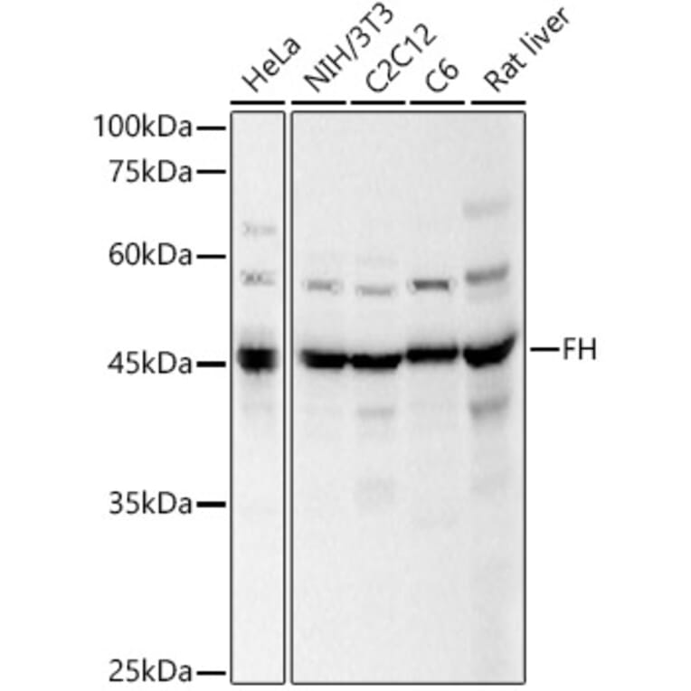 Western Blot - Anti-FH/Fumarase Antibody (A14907) - Antibodies.com
