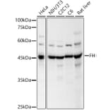Western Blot - Anti-FH/Fumarase Antibody (A14907) - Antibodies.com