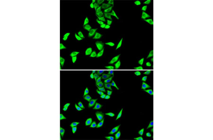 Immunofluorescence - Anti-FH/Fumarase Antibody (A14907) - Antibodies.com