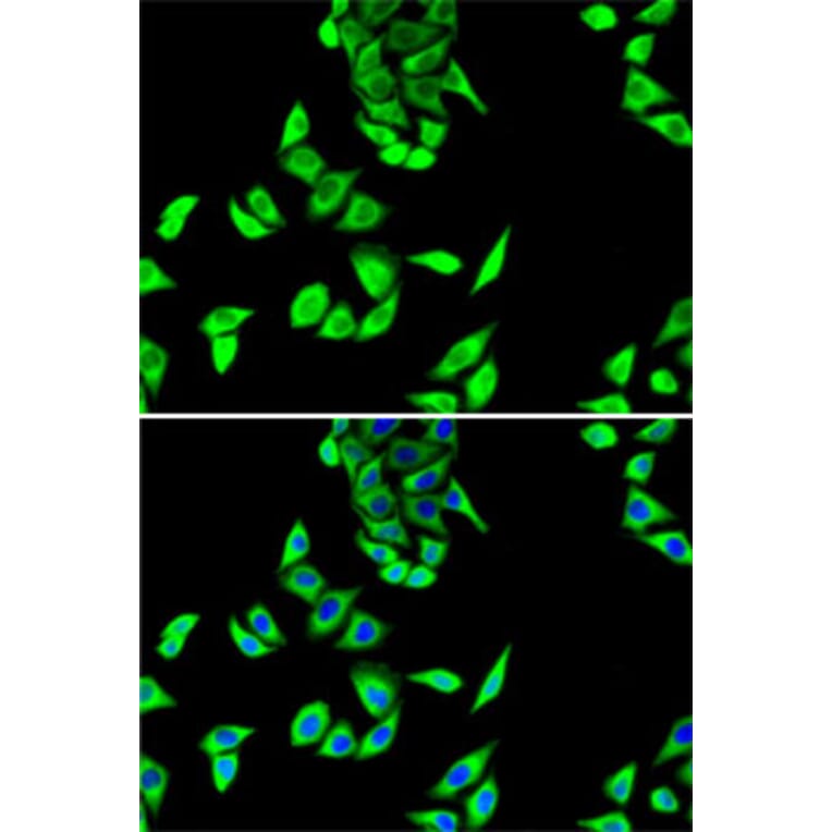 Immunofluorescence - Anti-FH/Fumarase Antibody (A14907) - Antibodies.com