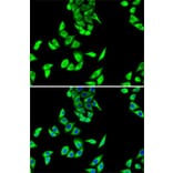 Immunofluorescence - Anti-FH/Fumarase Antibody (A14907) - Antibodies.com