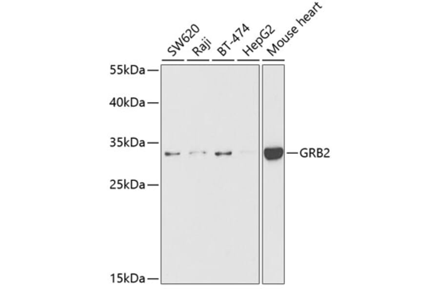 Western Blot - Anti-GRB2 Antibody (A14908) - Antibodies.com
