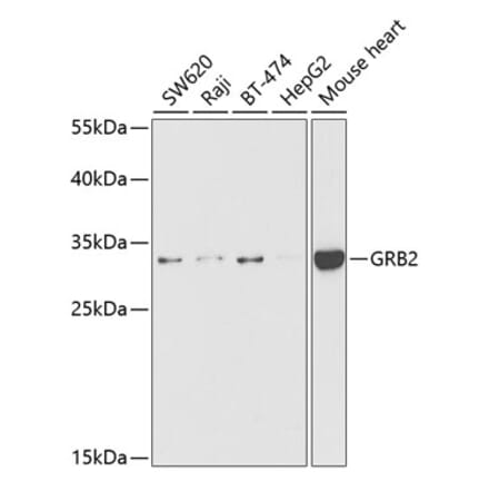 Western Blot - Anti-GRB2 Antibody (A14908) - Antibodies.com