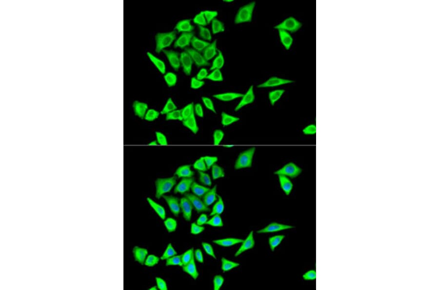 Immunofluorescence - Anti-GRB2 Antibody (A14908) - Antibodies.com