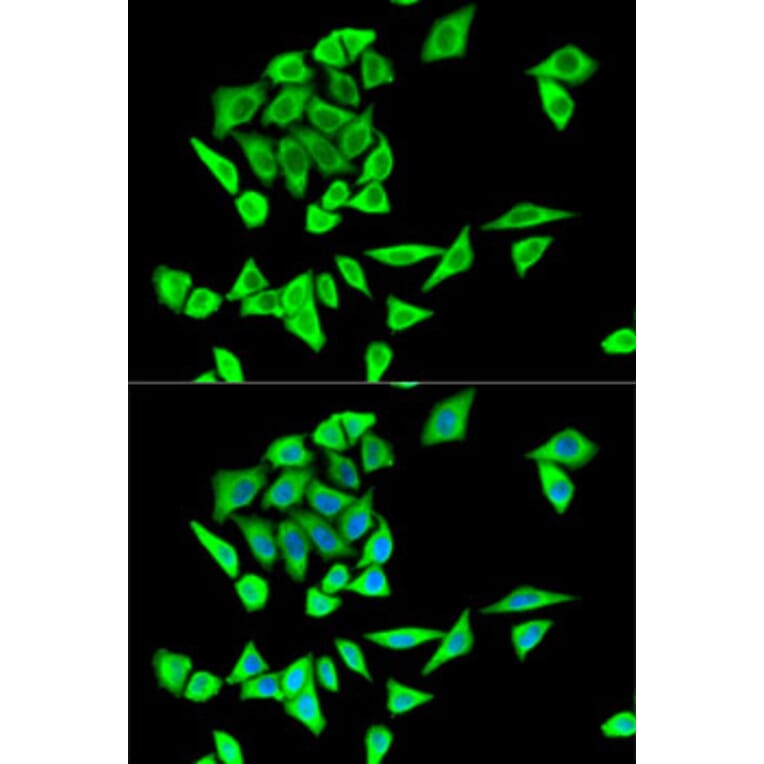 Immunofluorescence - Anti-GRB2 Antibody (A14908) - Antibodies.com
