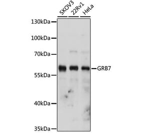 Western Blot - Anti-GRB7 Antibody (A14909) - Antibodies.com