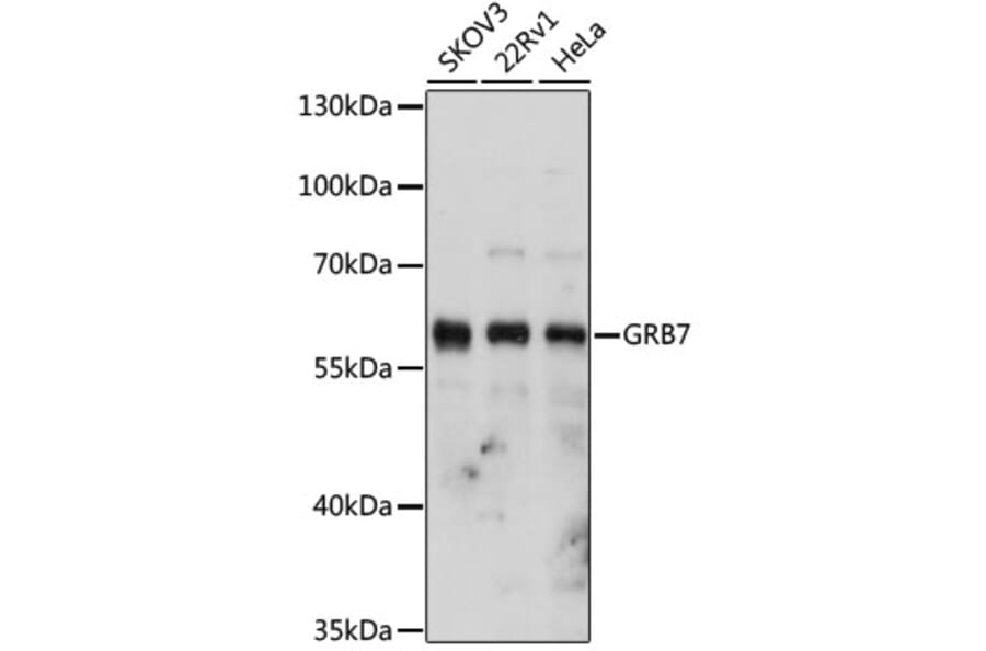 Western Blot - Anti-GRB7 Antibody (A14909) - Antibodies.com