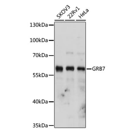 Western Blot - Anti-GRB7 Antibody (A14909) - Antibodies.com