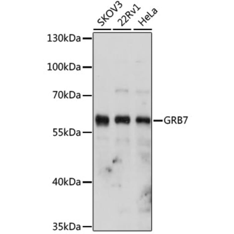 Western Blot - Anti-GRB7 Antibody (A14909) - Antibodies.com