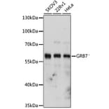 Western Blot - Anti-GRB7 Antibody (A14909) - Antibodies.com