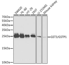 Western Blot - Anti-GST3 / GST pi Antibody (A14910) - Antibodies.com