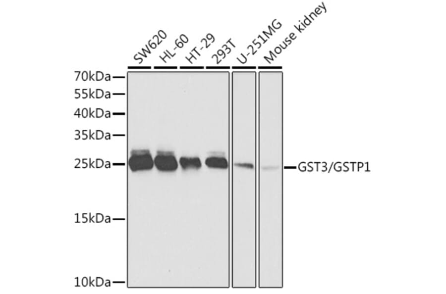 Western Blot - Anti-GST3/GST pi Antibody (A14910) - Antibodies.com