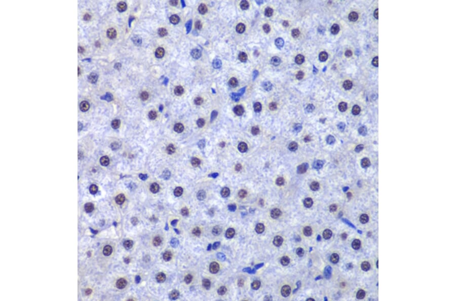 Immunohistochemistry - Anti-GST3/GST pi Antibody (A14910) - Antibodies.com