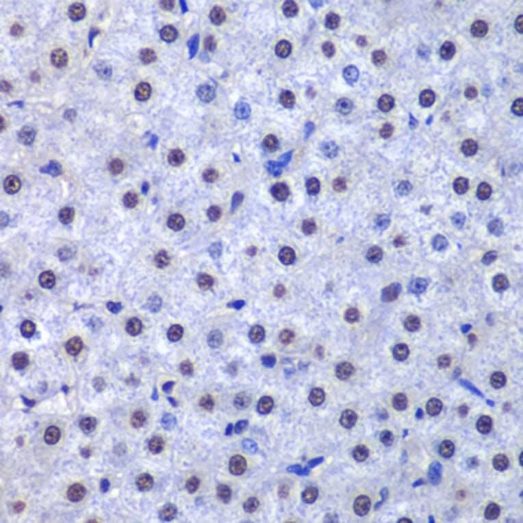 Immunohistochemistry - Anti-GST3/GST pi Antibody (A14910) - Antibodies.com