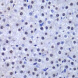 Immunohistochemistry - Anti-GST3/GST pi Antibody (A14910) - Antibodies.com
