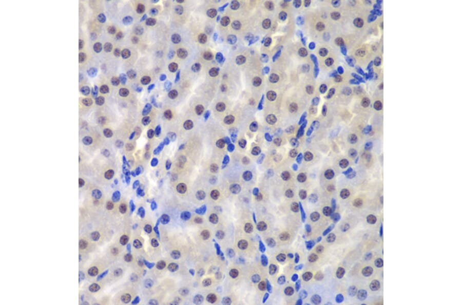 Immunohistochemistry - Anti-GST3/GST pi Antibody (A14910) - Antibodies.com