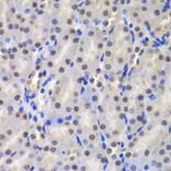 Immunohistochemistry - Anti-GST3/GST pi Antibody (A14910) - Antibodies.com