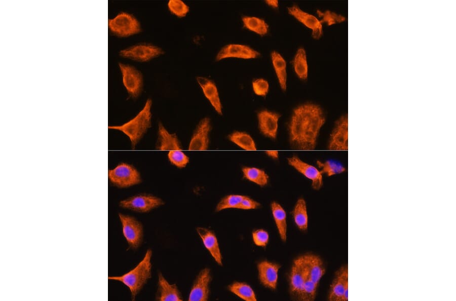 Immunofluorescence - Anti-GST3/GST pi Antibody (A14910) - Antibodies.com