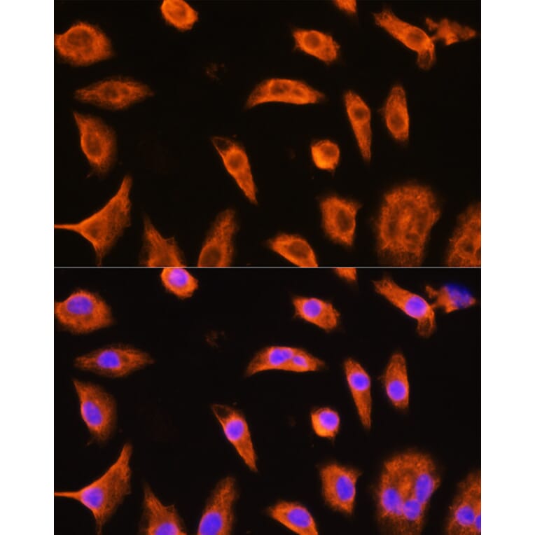 Immunofluorescence - Anti-GST3/GST pi Antibody (A14910) - Antibodies.com