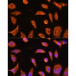 Immunofluorescence - Anti-GST3/GST pi Antibody (A14910) - Antibodies.com